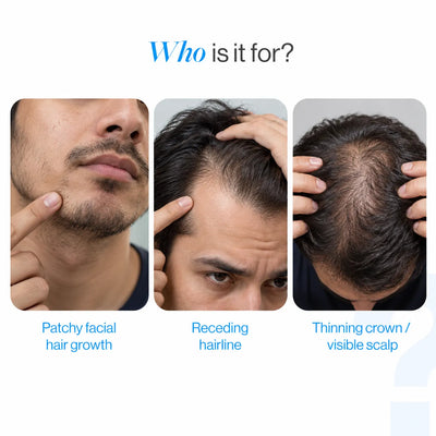 Vanalie™ Hair Growth Roll-On Serum