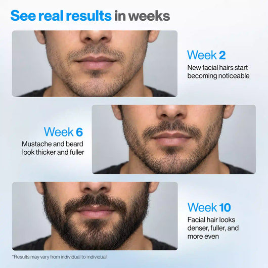 Vanalie™ Hair Growth Roll-On Serum
