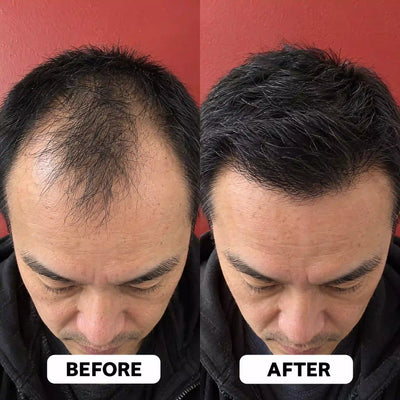 Vanalie™ Hair Growth Roll-On Serum
