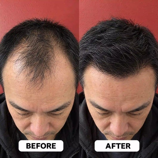 Vanalie™ Hair Growth Roll-On Serum