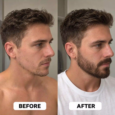 Vanalie™ Hair Growth Roll-On Serum