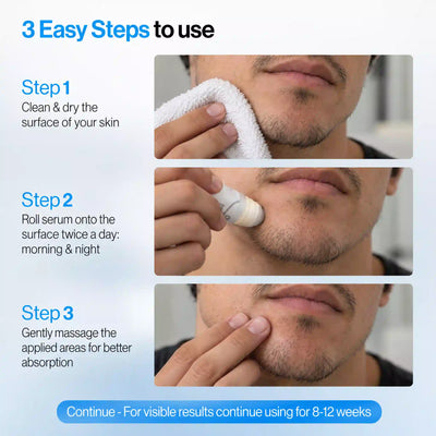 Vanalie™ Hair Growth Roll-On Serum